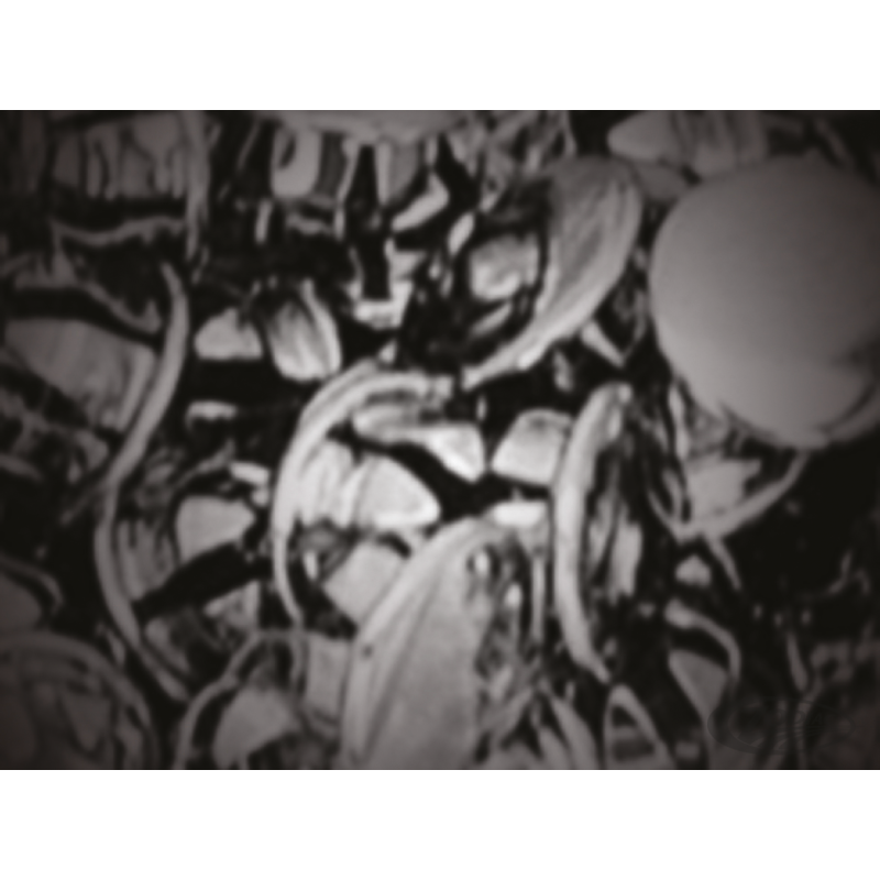 BOITE D'ASSORTIMENT DE BOUCHONS A TROU ALLEN